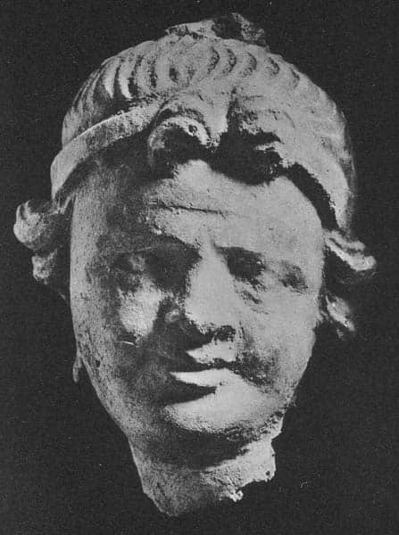 Head of Donor
