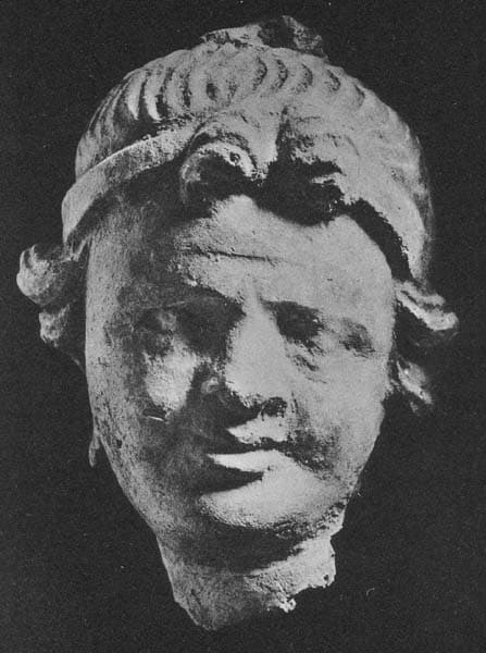 Head of Donor