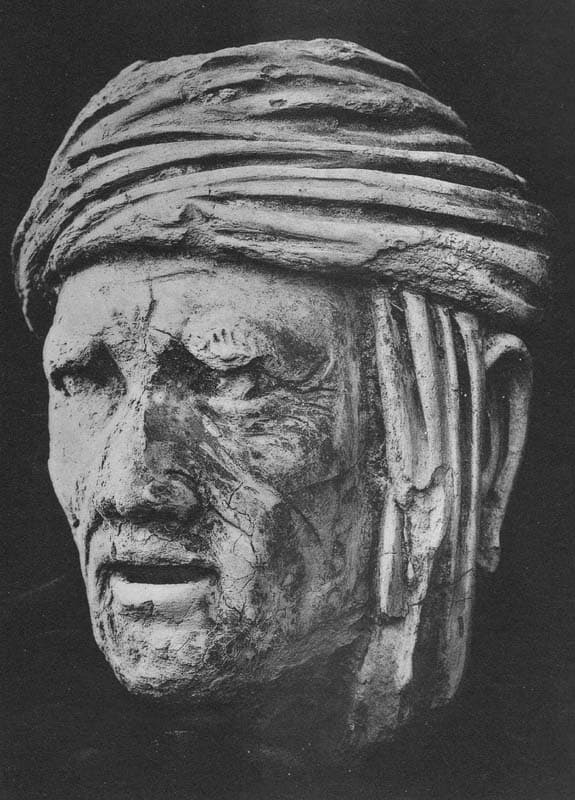 Head of an elderly donor