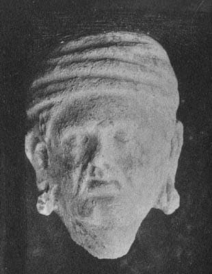 Head of an elderly donor